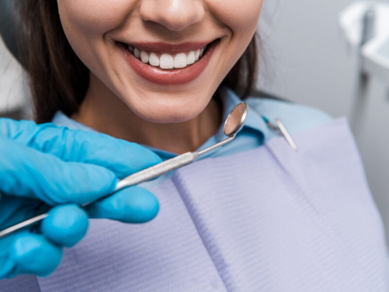 sorriso denti bianchi dal dentista